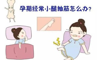 孕妇总抽筋—孕妇腿部痉挛困扰不断，缓解 *** 一网打尽