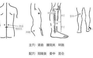 右侧坐骨痛怎么办—揭秘右侧坐骨痛的隐秘真相，释放无痛生活