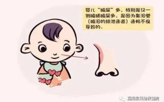 小孩眼屎突然增多_顽固眼屎困扰小儿健康