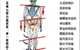 走路脚疼筋疼_足步生疼，筋骨作祟：解锁行走自由