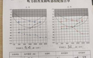 左耳下边痛_左耳下疼痛：病因分析及治疗 *** 详解