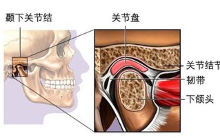 左侧挂钩疼_左侧挂钩疼导致头疼