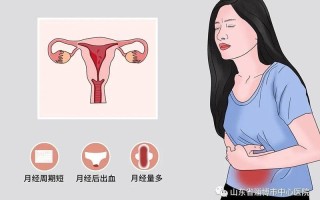 子宫功能性出血吃什么药调理好_子宫异常出血：病因、诊断与管理探究