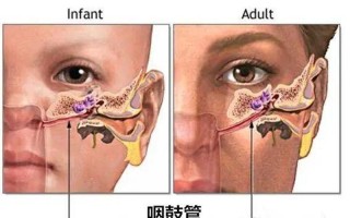 中耳炎能根治吗仁品地址_中耳炎的福音：彻底根治还是遥不可及？