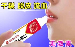 嘴皮经常起皮—嘴皮经常起皮吃什么药