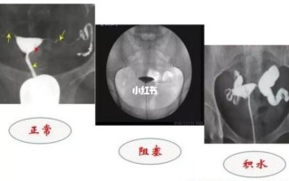 照影是什么意思—照影何物：从光影到心灵的自我发现之旅