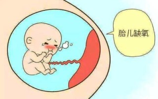 孕妇早晨起来头晕晕的是什么原因—孕妇清晨头晕困扰 多种原因亟待探究