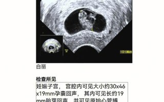 孕酮一直在降—孕酮持续走低，警惕胎儿发育异常