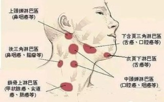 右面脖子疼_右颈疼痛：病因鉴别与缓解之道