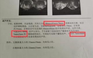 子宫上有小泡泡照片_子宫微囊下的秘密：探寻隐匿的病灶