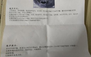 孕早期孕酮高了对胎儿有影响吗(孕早期孕酮飙升：原因与影响探索)