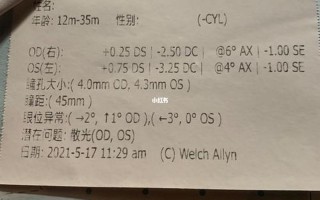 6个月宝宝散光多少度正常(散光多少度才是正常眼？轻松掌握散光知识)