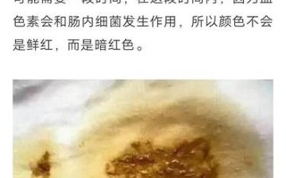 怎样才算黑便(正常黑便的图片标准)