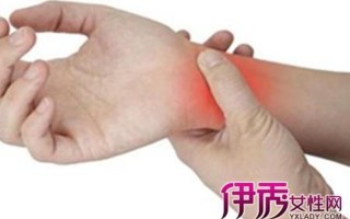 孕妇手腕疼—孕妇手腕疼如何缓解