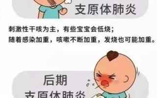 儿童反复咳嗽—儿童反复咳嗽：警惕隐藏的呼吸道疾病