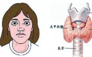 甲状腺亢进对怀孕有影响吗—甲状腺亢进：从诊断到治疗的全方位解读