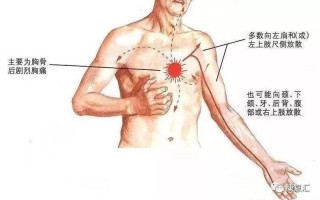 左胸按肉疼—左胸隐痛如刀割，究竟是心绞痛还是心脏病