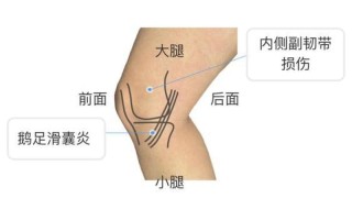 内侧疼痛—内侧疼痛的原因