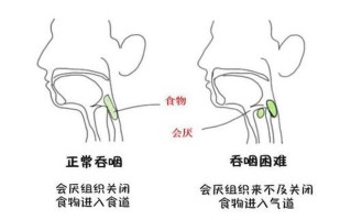 孕13周有褐色分泌物—孕13周有褐色分泌物会流产吗