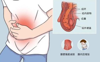 怀孕后小腹涨_怀孕以后小腹胀胀的