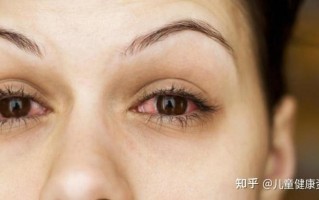 早上眼睛干涩流眼泪怎么回事—清晨困扰：恼人的眼睛干涩症