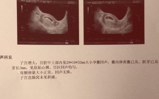 孕六个月腿疼—孕肚隆起腿疼痛困扰准妈妈 应对秘方缓解不适