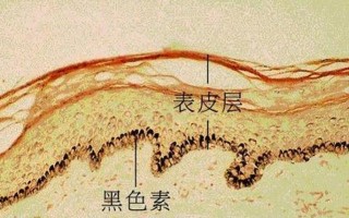 腋下掉皮是怎么回事(腋下脱皮的元凶找到了 解锁光滑肌肤的秘诀)