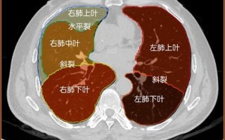 左侧胸腔刺痛(左侧胸腔灼心刺痛：不容忽视的心肺隐忧)