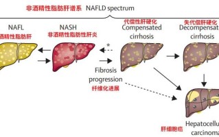 脂肪肝原因(揭开脂肪肝的成因之谜：从病理到生活方式)