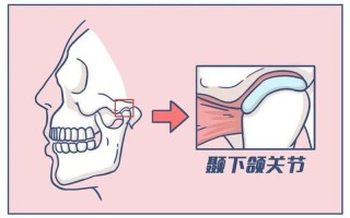 咬合肌疼痛—一侧咬合肌疼痛