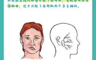 右脸颊抽搐—右颊不宁，缘何抽动？面部痉挛，揭示隐秘神经