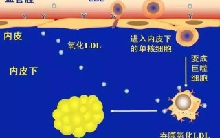 怎样降低脂蛋白a700(解锁降脂蛋白a秘诀：科学 *** 化解心血管隐忧)