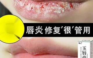 孕期嘴唇干裂脱皮(孕期嘴唇脱皮干裂原因)