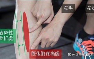 运动完小腿酸痛什么原因—运动后的小腿酸痛：成因、缓解与预防