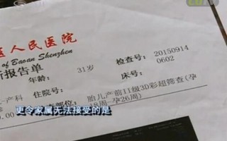 做b超挂什么科—去医院做b超挂什么科